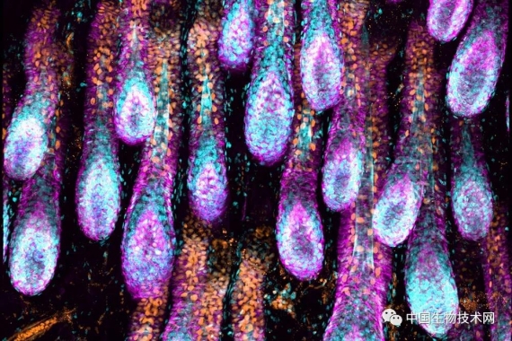 Science新概念：淋巴系统在脱发和伤口愈合中起关键作用